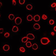 Illustration for article titled Exploding nanoparticles (literally) open up the path to repairing damaged cells